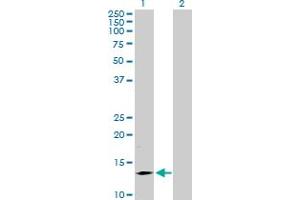 Western Blot analysis of SMA4 expression in transfected 293T cell line by SMA4 MaxPab polyclonal antibody. (SMN1 抗体  (AA 1-140))