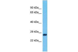 Western Blotting (WB) image for anti-Zinc Finger, CCHC Domain Containing 9 (ZCCHC9) (C-Term) antibody (ABIN2788488) (ZCCHC9 抗体  (C-Term))