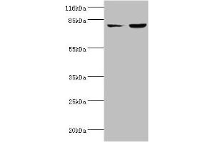 Western blot All lanes: ACSL4 antibody at 2 μg/mL Lane 1: HepG2 whole cell lysate Lane 2: Hela whole cell lysate Secondary Goat polyclonal to rabbit IgG at 1/10000 dilution Predicted band size: 80, 75 kDa Observed band size: 80 kDa (ACSL4 抗体  (AA 457-670))