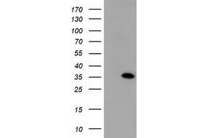 Image no. 1 for anti-Sulfotransferase Family, Cytosolic, 1A, Phenol-Preferring, Member 1 (SULT1A1) antibody (ABIN1501225) (SULT1A1 抗体)