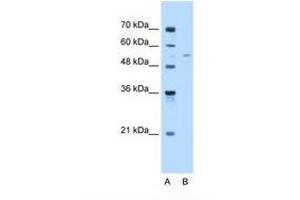Image no. 1 for anti-Fatty Acyl CoA Reductase 2 (FAR2) (AA 401-450) antibody (ABIN6738351) (FAR2 抗体  (AA 401-450))