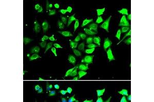 Immunofluorescence analysis of A549 cells using FKBP8 Polyclonal Antibody