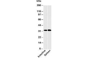 Western blot testing of human samples with CLEC1 antibody at 2ug/ml.