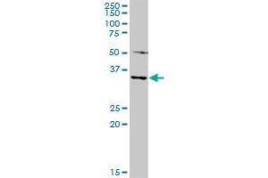 MAGEA4 MaxPab rabbit polyclonal antibody. (MAGEA4 抗体  (AA 1-317))