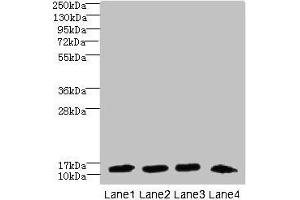 Western blot All lanes: DNAL4 antibody at 1. (DNAL4 抗体  (AA 1-105))