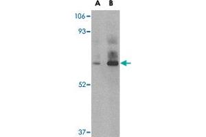 Western blot analysis of DHX58 in rat kidney tissue lysate with DHX58 polyclonal antibody  at (A) 1 and (B) 2 ug/mL . (DHX58 抗体  (C-Term))