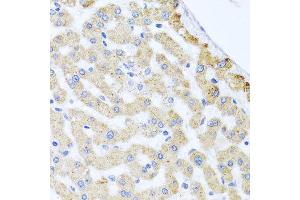 Immunohistochemistry of paraffin-embedded human liver injury using CETN3 antibody at dilution of 1:100 (x40 lens). (CETN3 抗体)