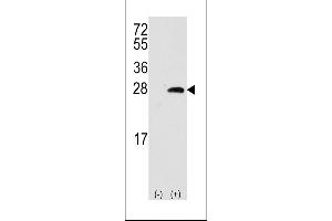 Western blot analysis of OPRS1 using rabbit polyclonal OPRS1 Antibody. (SIGMAR1 抗体  (AA 118-147))