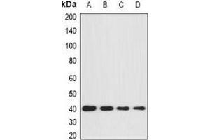 Western blot analysis of GNA11 expression in BT474 (A), SKOV3 (B), mouse brain (C), mouse kidney (D) whole cell lysates. (GNA11 抗体)
