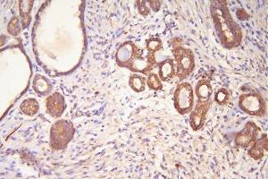 IHC analysis of Hsp20 using anti-Hsp20 antibody (ABIN5518920).