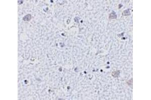 Immunohistochemistry of BRSK1 in human brain tissue with BRSK1 antibody at 5 μg/ml. (BRSK1 抗体  (Center))