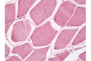 Immunohistochemistry (IHC) image for anti-NADH Dehydrogenase (Ubiquinone) 1 alpha Subcomplex, 1, 7.5kDa (NDUFA1) antibody (Biotin) (ABIN1955836)