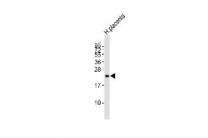 Western Blot at 1:2000 dilution + human placenta lysates Lysates/proteins at 20 ug per lane. (CGB 抗体  (C-Term))