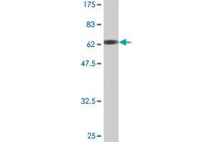 Western Blot detection against Immunogen (67. (MEIS2 抗体  (AA 1-381))