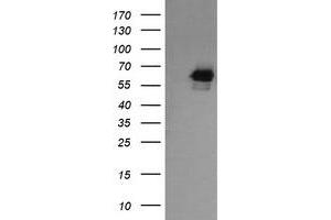Image no. 6 for anti-RIO Kinase 2 (RIOK2) (AA 277-552) antibody (ABIN1491305) (RIOK2 抗体  (AA 277-552))