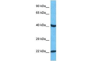 Host:  Rabbit  Target Name:  PAX3  Sample Type:  HepG2 Whole Cell lysates  Antibody Dilution:  1. (Paired Box 3 抗体  (C-Term))
