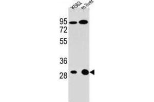 Western Blotting (WB) image for anti-Electron-Transfer-Flavoprotein, alpha Polypeptide (ETFA) antibody (ABIN2996035) (ETFA 抗体)
