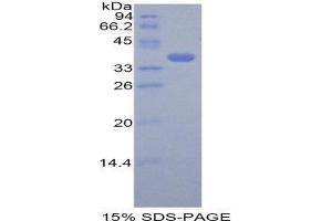 SDS-PAGE (SDS) image for Cystatin A (Stefin A) (CSTA) (AA 1-97) protein (His tag,GST tag) (ABIN1821594) (CSTA Protein (AA 1-97) (His tag,GST tag))