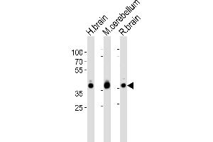 Western blot analysis of lysates from human brain, mouse cerebellum and rat brain tissue lysate (from left to right), using ALDOC Antibody (C-term) (ABIN389207 and ABIN2839365). (ALDOC 抗体  (C-Term))