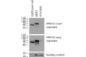 Western blotting analysis of human PPM1D using mouse monoclonal antibody 7E11/C5 on lysates of U2OS parental cells, expressing both natural (70 kDa, low expression) and C-terminally truncated version (55 kDa, high expression) of PPM1D, and on lysates of MCF7 cells (high PPM1D expression) and RPE cells (low PPM1D expression), reducing conditions. (PPM1D 抗体)