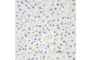 Immunohistochemistry of paraffin-embedded rat liver using WDR48 antibody (ABIN5974731) at dilution of 1/100 (40x lens). (WDR48 抗体)