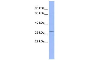 WB Suggested Anti-OTP Antibody Titration:  0. (OTP 抗体  (N-Term))