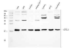 Western blot analysis of Cofilin using anti-Cofilin antibody (ABIN3042746). (Cofilin 抗体  (C-Term))