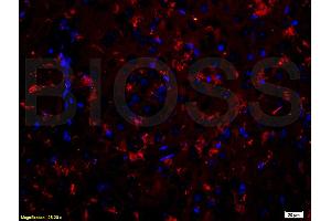 Formalin-fixed and paraffin-embedded rat brain labeled with Anti-CDH2/N-cadherin Polyclonal Antibody, Unconjugated (ABIN738726) 1:200, overnight at 4°C, The secondary antibody was Goat Anti-Rabbit IgG, PE conjugated used at 1:200 dilution for 40 minutes at 37°C. (N-Cadherin 抗体  (AA 701-800))