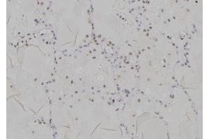ABIN6266177 and ABIN6277196 at 1/100 staining Human lung tissue by IHC-P.