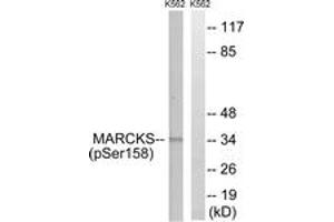 Western blot analysis of extracts from K562 cells treated with EGF 200ng/ml 30', using MARCKS (Phospho-Ser158) Antibody. (MARCKS 抗体  (pSer159))