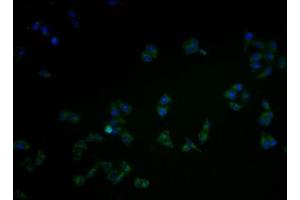 Immunofluorescence staining of Hela cells with ABIN7146440 at 1:100, counter-stained with DAPI. (CAMK2A 抗体  (AA 321-478))