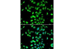 Immunofluorescence (IF) image for anti-serpin Peptidase Inhibitor, Clade A (Alpha-1 Antiproteinase, Antitrypsin), Member 4 (SERPINA4) (AA 178-427) antibody (ABIN6147573)