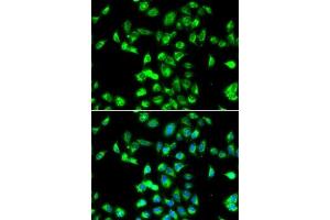 Immunofluorescence analysis of MCF7 cells using Kallistatin (SERPIN) antibody (ABIN6131346, ABIN6147573, ABIN6147574 and ABIN6223161). (SERPINA4 抗体  (AA 178-427))