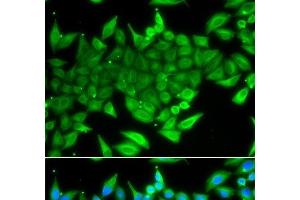 Immunofluorescence analysis of A549 cells using TTF2 Polyclonal Antibody (TTF2 抗体)