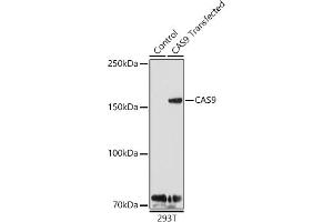 Western blot analysis of extracts of 293T cells and 293T transfected with C protein, using C antibody (ABIN7266523) at 1:1000 dilution.