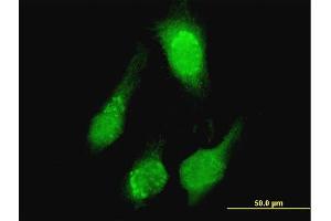 Immunofluorescence of purified MaxPab antibody to TCL1A on HeLa cell. (TCL1A 抗体  (AA 1-114))