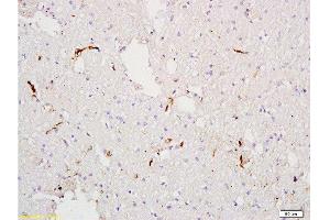 Formalin-fixed and paraffin embedded rat tibia tissue labeled with Anti-Factor VIII (FVIII) Polyclonal Antibody , Unconjugated at 1:300, followed by conjugation to the secondary antibody and DAB staining (Factor VIII 抗体  (AA 401-500))