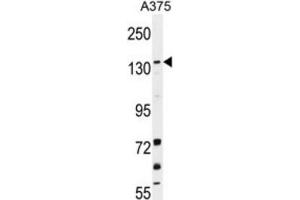 Western Blotting (WB) image for anti-Lysine (K)-Specific Demethylase 4B (KDM4B) antibody (ABIN2996453)