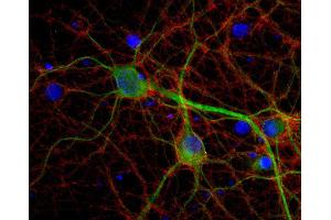 Indirect immunostaining of PFA fixed rat hippocampus neurons with anti-Munc18-1, (dilution 1 : 500; red) and mouse anti-MAP 2 (, dilution 1 : 1000; green).