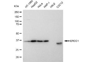 Western blotting analysis using ERCC1 antibody (ABIN7798539). (Recombinant ERCC1 抗体)