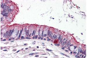 Human Lung (formalin-fixed, paraffin-embedded) stained with ELOVL6 antibody ABIN343916 at 5 ug/ml followed by biotinylated goat anti-rabbit IgG secondary antibody ABIN481713, alkaline phosphatase-streptavidin and chromogen. (ELOVL6 抗体  (N-Term))