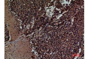 Immunohistochemistry (IHC) image for anti-Killer Cell Immunoglobulin-Like Receptor, three Domains, Long Cytoplasmic Tail, 3 (KIR3DL3) (Internal Region) antibody (ABIN6282363)