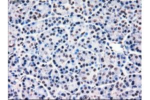 Immunohistochemical staining of paraffin-embedded Ovary tissue using anti-MRI1mouse monoclonal antibody. (MRI1 抗体)