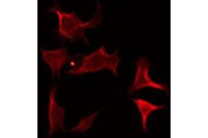 Immunofluorescence (fixed cells) (IF/ICC) image for anti-Calcium Channel, Voltage-Dependent, alpha 2/delta Subunit 4 (CACNA2D4) (Internal Region) antibody (ABIN6257978)