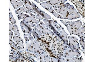 IHC analysis of Transketolase/TKT using anti-Transketolase/TKT antibody (ABIN7598958).