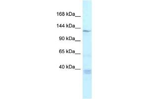 WB Suggested Anti-Tnks Antibody Titration: 1. (TNKS 抗体  (Middle Region))