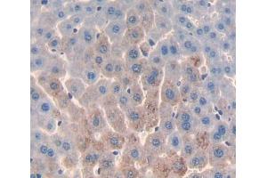 Immunohistochemistry (IHC) image for anti-Acid Phosphatase 6, Lysophosphatidic (ACP6) (AA 1-418) antibody (ABIN5013065)