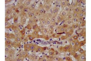 IHC image of ABIN7143624 diluted at 1:700 and staining in paraffin-embedded human liver tissue performed on a Leica BondTM system. (AGXT2 抗体  (AA 196-328))