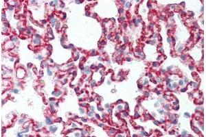 Rat Lung (formalin-fixed, paraffin-embedded) stained with CLDN5 antibody ABIN337059 at 5-10 ug/ml followed by biotinylated anti-mouse IgG secondary antibody ABIN481714, alkaline phosphatase-streptavidin and chromogen. (Claudin 5 抗体)