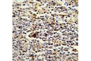 CD1e antibody immunohistochemistry analysis in formalin fixed and paraffin embedded human spleen. (CD1e 抗体  (AA 184-212))